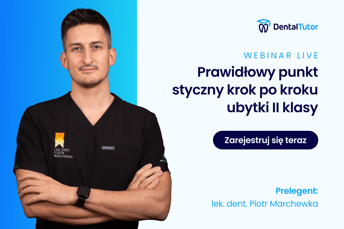 Druga klasa – perfekcyjny punkt styczny bez tajemnic