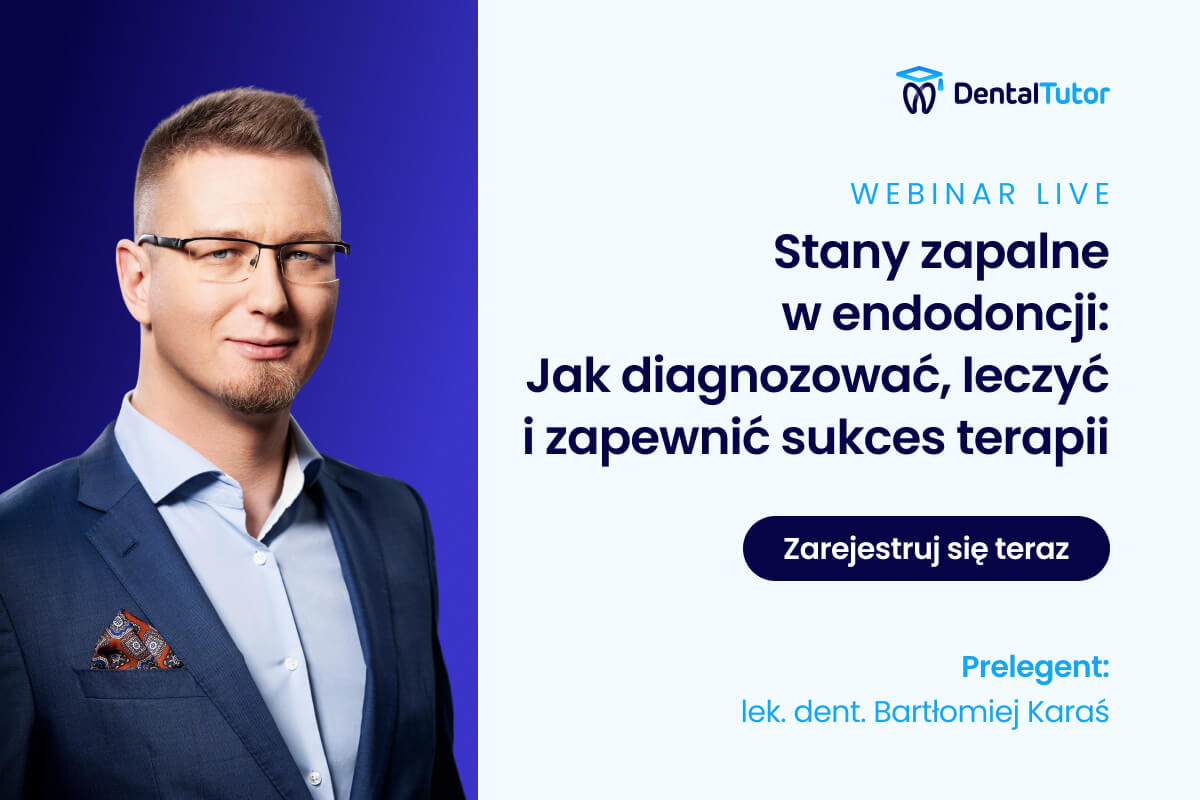 Stany Zapalne w Endodoncji: Jak Diagnozować, Leczyć i Zapewnić Sukces Terapii