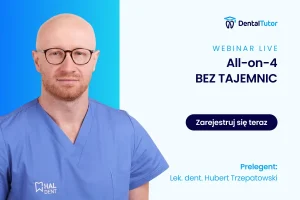 All-on-4 BEZ TAJEMNIC