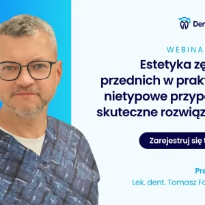 Estetyka zębów przednich w praktyce: nietypowe przypadki, skuteczne rozwiązania