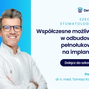 Współczesne możliwości w odbudowach pełnołukowych na implantach