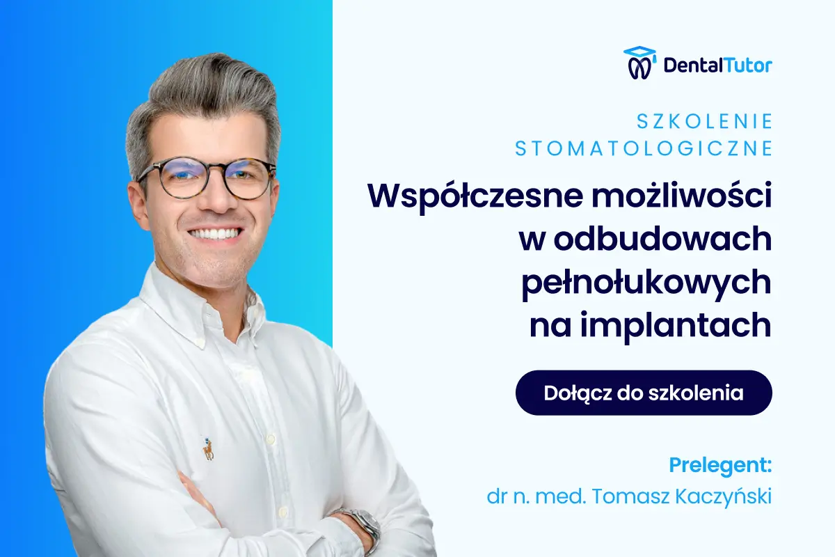 Współczesne możliwości w odbudowach pełnołukowych na implantach