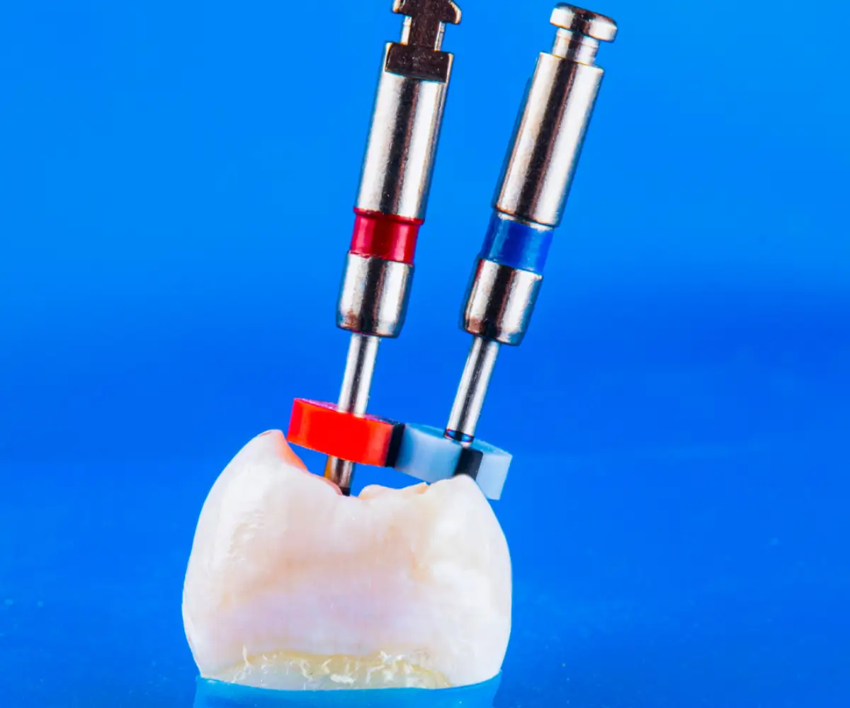 Lekcja 5 – Opracowanie kanałów