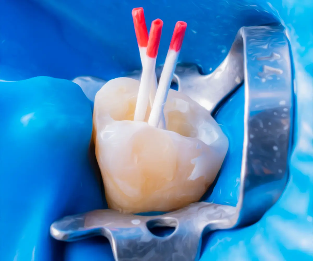 Lekcja 6 – Wypełnianie kanałów