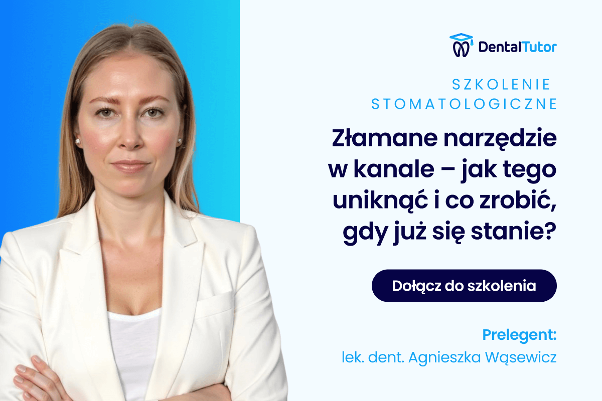 Złamane narzędzie w kanale – jak tego uniknąć i co zrobić, gdy już się stanie?